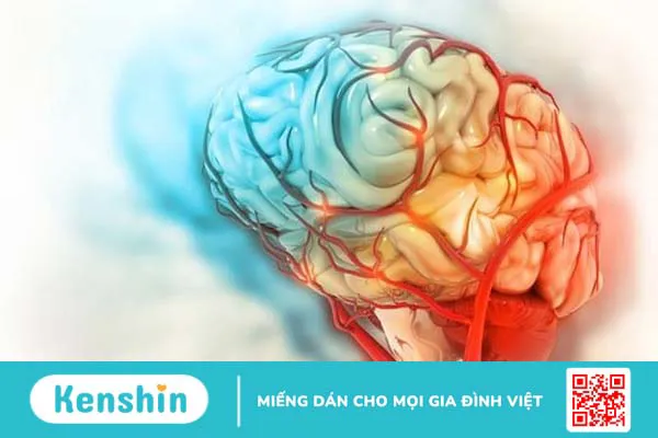 Những dấu hiệu não có vấn đề thường gặp