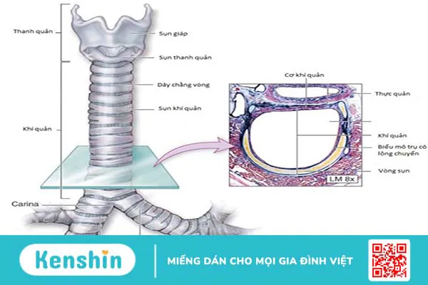 Những điều bạn cần biết về bệnh lý nhuyễn sụn khí quản