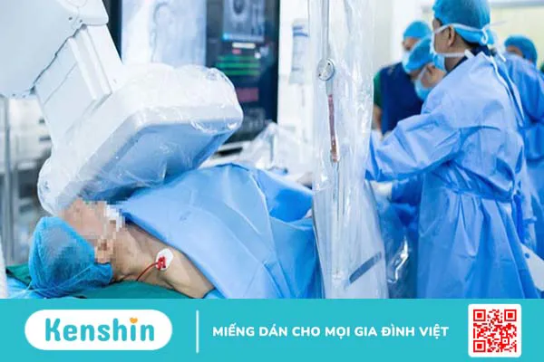 Những điều bạn cần biết về phương pháp chụp động mạch vành qua da