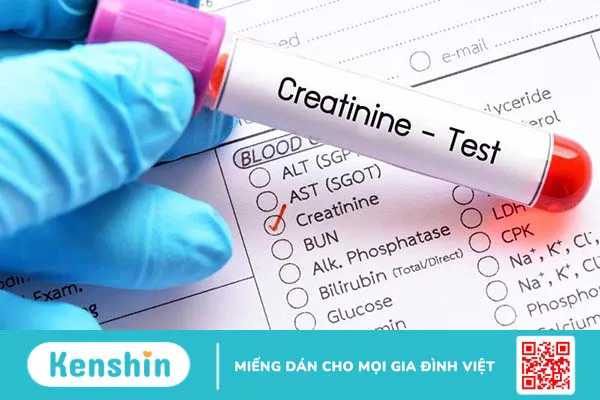 Những điều cần biết và lưu ý khi khám thận 3