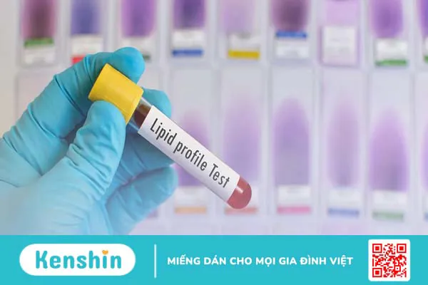 Những điều cần biết về bệnh mỡ máu gia đình