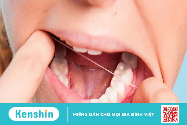 Những điều cần biết về nhổ răng khôn mọc lệch