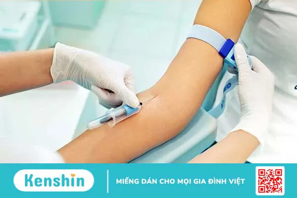 Những điều cần biết về phương pháp đặt catheter tĩnh mạch trung ương