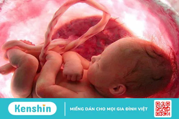 Những điều cần biết về phương pháp đo AFI và ý nghĩa của chỉ số nước ối AFI 1