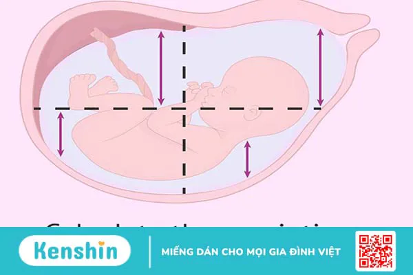 Những điều cần biết về phương pháp đo AFI và ý nghĩa của chỉ số nước ối AFI 2