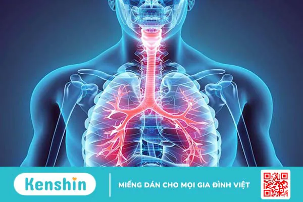 Những điều cần biết về sẹo hẹp khí quản 1