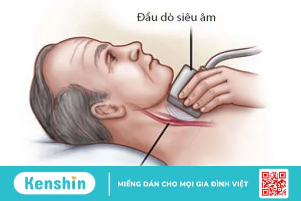 Những điều cần biết về siêu âm động mạch cảnh 3