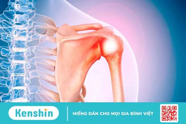 Những điều cần biết về sụn và nguyên nhân gây ra tổn thương sụn thường gặp