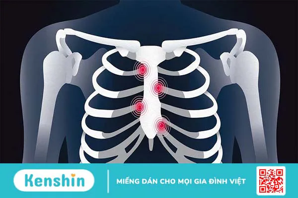 Những điều cần biết về sụn và nguyên nhân gây ra tổn thương sụn thường gặp