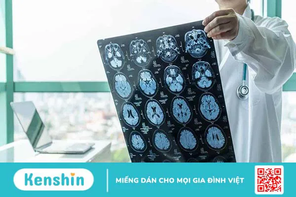 Những điều cần biết về u màng não lành tính 6