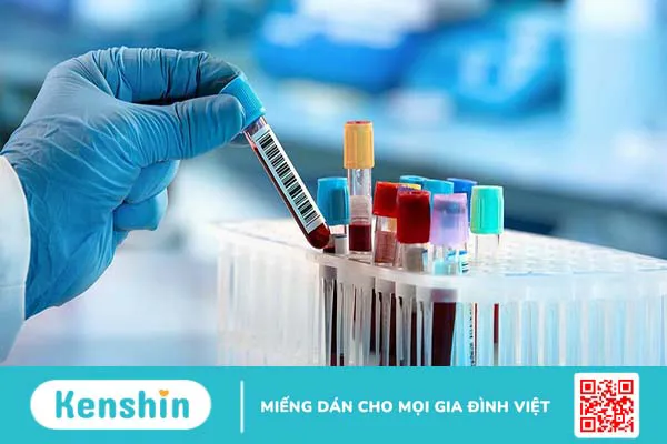 Những điều cần biết về xét nghiệm dấu ấn miễn dịch bề mặt tế bào