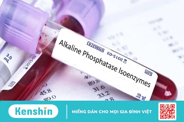 Những điều cần biết về xét nghiệm phosphatase kiềm