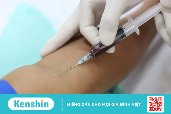 Những điều cần biết về xét nghiệm phosphatase kiềm 3