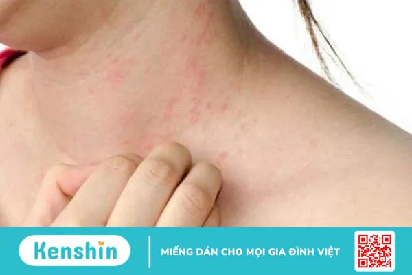 Những kinh nghiệm khi đi khám bệnh viện da liễu 3