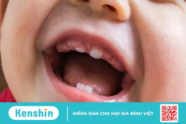 Những răng sữa nào không thay? Cách chăm sóc răng miệng cho trẻ