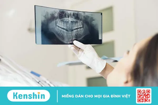 Những thông tin cần biết về bọc răng sứ lava esthetic 3