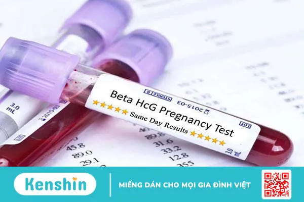 Những thông tin cần biết về kết quả xét nghiệm máu có thai