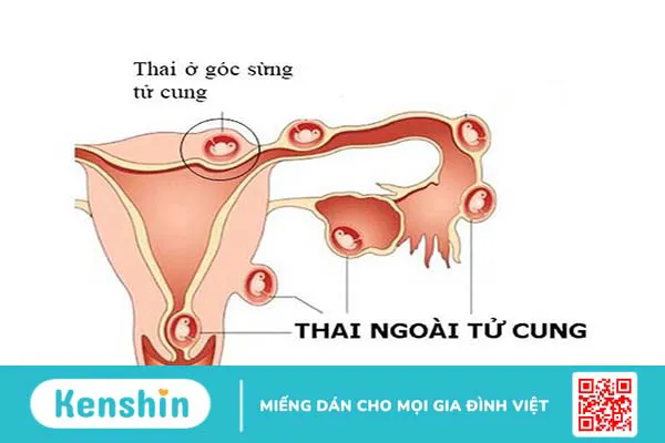 Những thông tin cần biết về kết quả xét nghiệm máu có thai