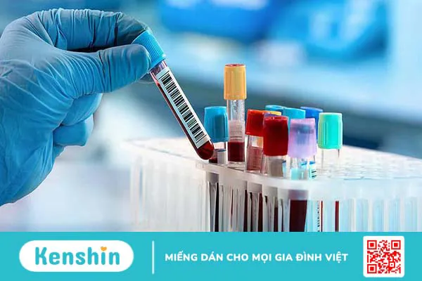 Những thông tin cơ bản về bệnh thận đa nang bẩm sinh không phải ai cũng biết 3