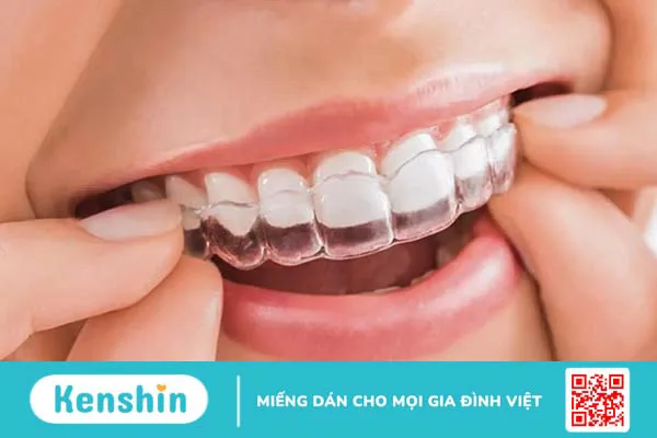 Những trường hợp nào nên thực hiện nắn chỉnh răng? 3