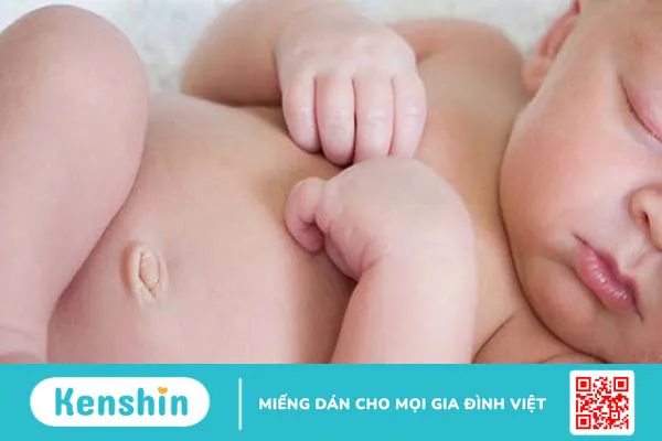 Những vấn đề thường gặp ở rốn trẻ sơ sinh