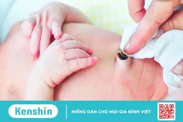 Những vấn đề thường gặp ở rốn trẻ sơ sinh 3