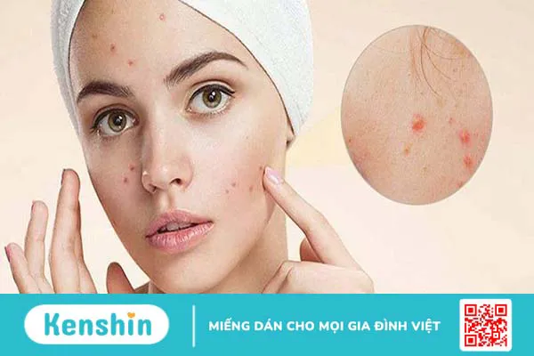 Niacinamide dùng sáng hay tối mới tốt? Cần lưu ý những gì? 2