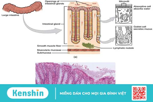 Niêm mạc ruột là gì? Tác động của thực phẩm và lối sống đối với vai trò của niêm mạc ruột