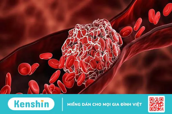 Nội mạc mạch máu là gì? Các bệnh lý liên quan đến rối loạn nội mạc mạch máu 2