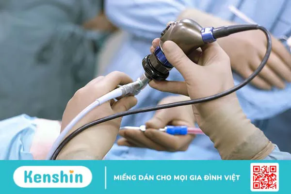 Nội soi siêu âm đường tiêu hóa trên: Để làm gì? Thực hiện như thế nào?