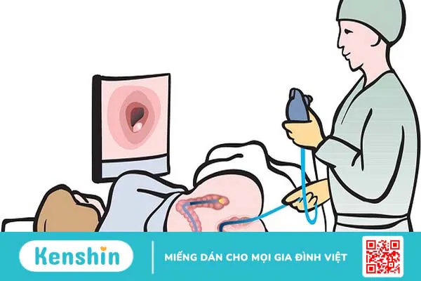 Nội soi trực tràng: Quy trình và những lưu ý khi thực hiện