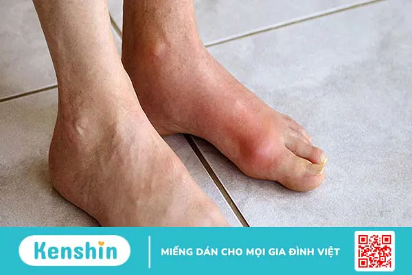 Nội tạng động vật bao lâu ăn một lần? Đối tượng nào hạn chế ăn?