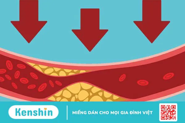 Non HDL cholesterol là gì và tầm quan trọng của nó đối với sức khỏe