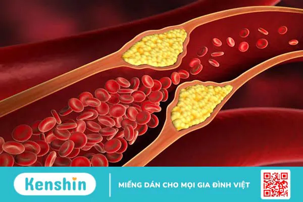 Non HDL cholesterol là gì và tầm quan trọng của nó đối với sức khỏe