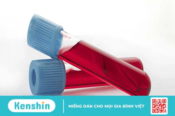 Non HDL cholesterol là gì và tầm quan trọng của nó đối với sức khỏe