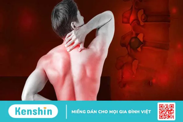 Nóng rát sau lưng có phải dấu hiệu của bệnh không?