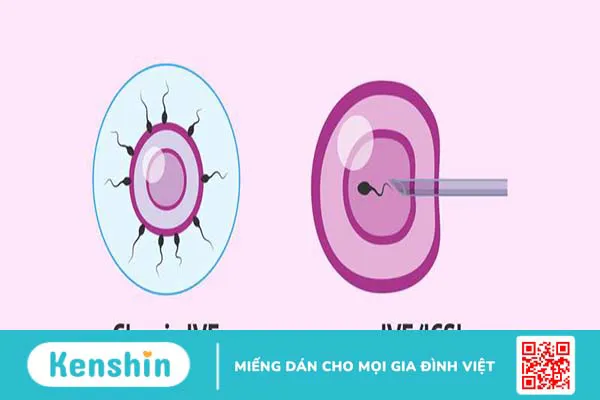 Nuôi cấy phôi là gì? Quy trình nuôi cấy phôi diễn ra như thế nào?