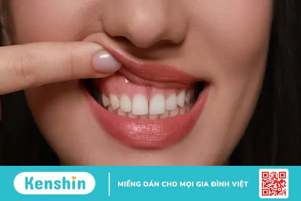 Nướu là gì? Cấu tạo và chức năng của nướu 1