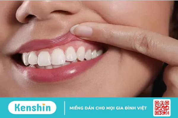 Nướu là gì? Cấu tạo và chức năng của nướu 2