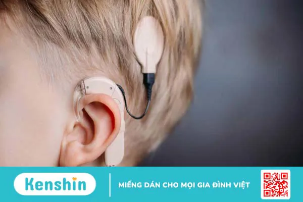 Ốc tai có cấu tạo như thế nào? Các bệnh lý về ốc tai thường gặp