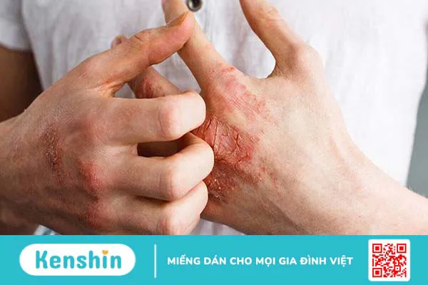 Ống dẫn tinh là gì? Một số thông tin về bệnh tắc ống dẫn tinh bạn cần biết