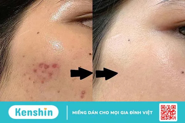 Panthenol là gì? Có tác dụng gì trong chăm sóc da? 3