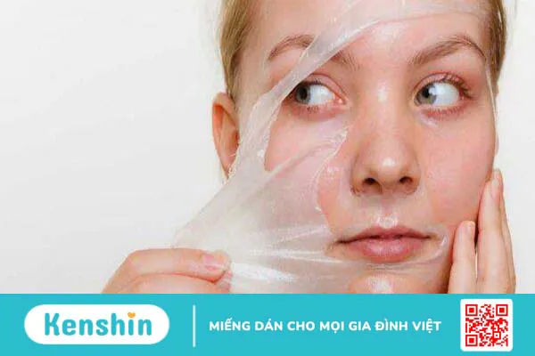 Peel da trị mụn có tốt không? Ưu và nhược điểm của quá trình peel da trị mụn?