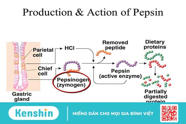 Pepsinogen 1 thấp có phải là dấu hiệu của ung thư dạ dày?