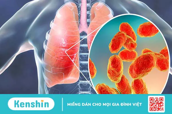 Những điều cần biết và phác đồ điều trị Mycoplasma 2