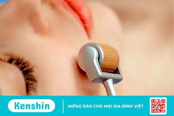 Phân biệt lăn kim và phi kim khác nhau như thế nào?