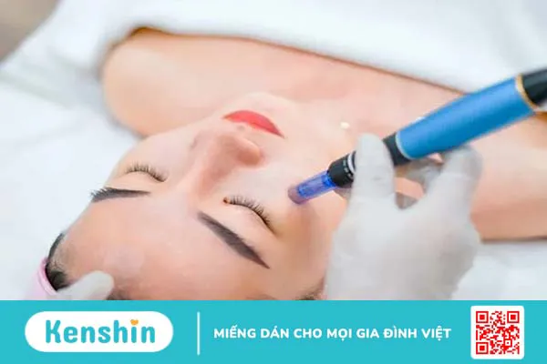 Phân biệt lăn kim và phi kim khác nhau như thế nào?