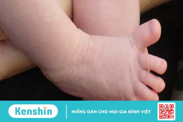 Phản xạ bó tháp và những điều cần biết