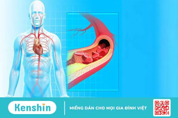 Phản xạ giảm áp là gì? Vai trò của phản xạ giảm áp trong sức khỏe tim mạch