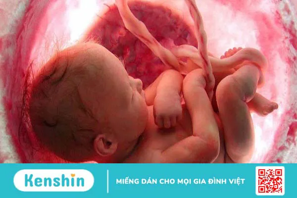 Phẫu thuật kênh nhĩ thất toàn phần: Giải pháp cho bệnh lý tim bẩm sinh nguy hiểm 1